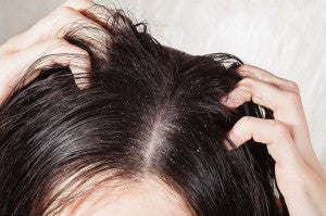 How to Treat an Oily Scalp